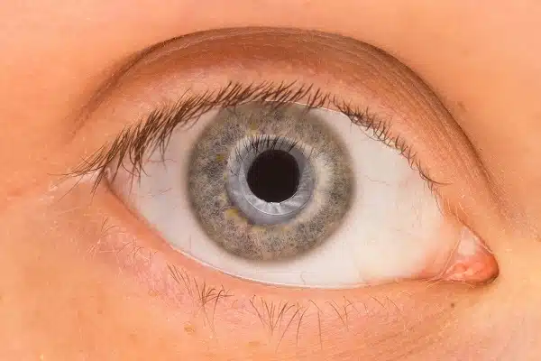 Gray eyes